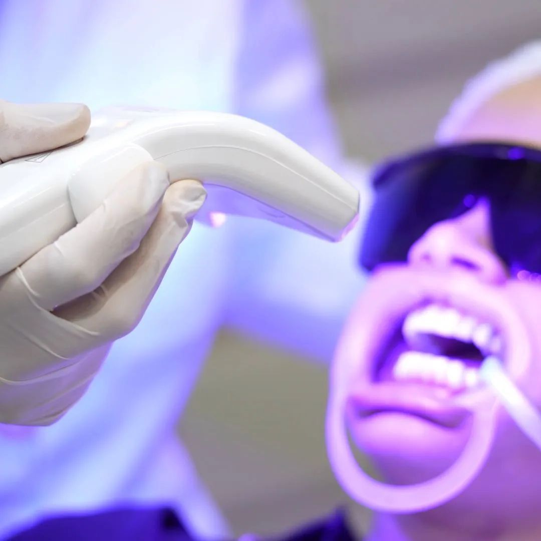 Imagem de clareamento dental