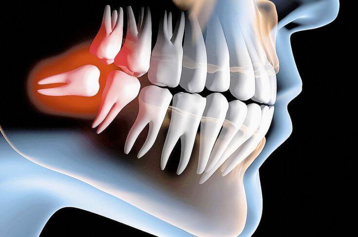 Imagem de cirurgia